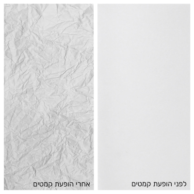 טיפולים להעלמת קמטים_בוטוקס וחומצה היאלורונית_מנתח פלסטי_לאוניד קוגן