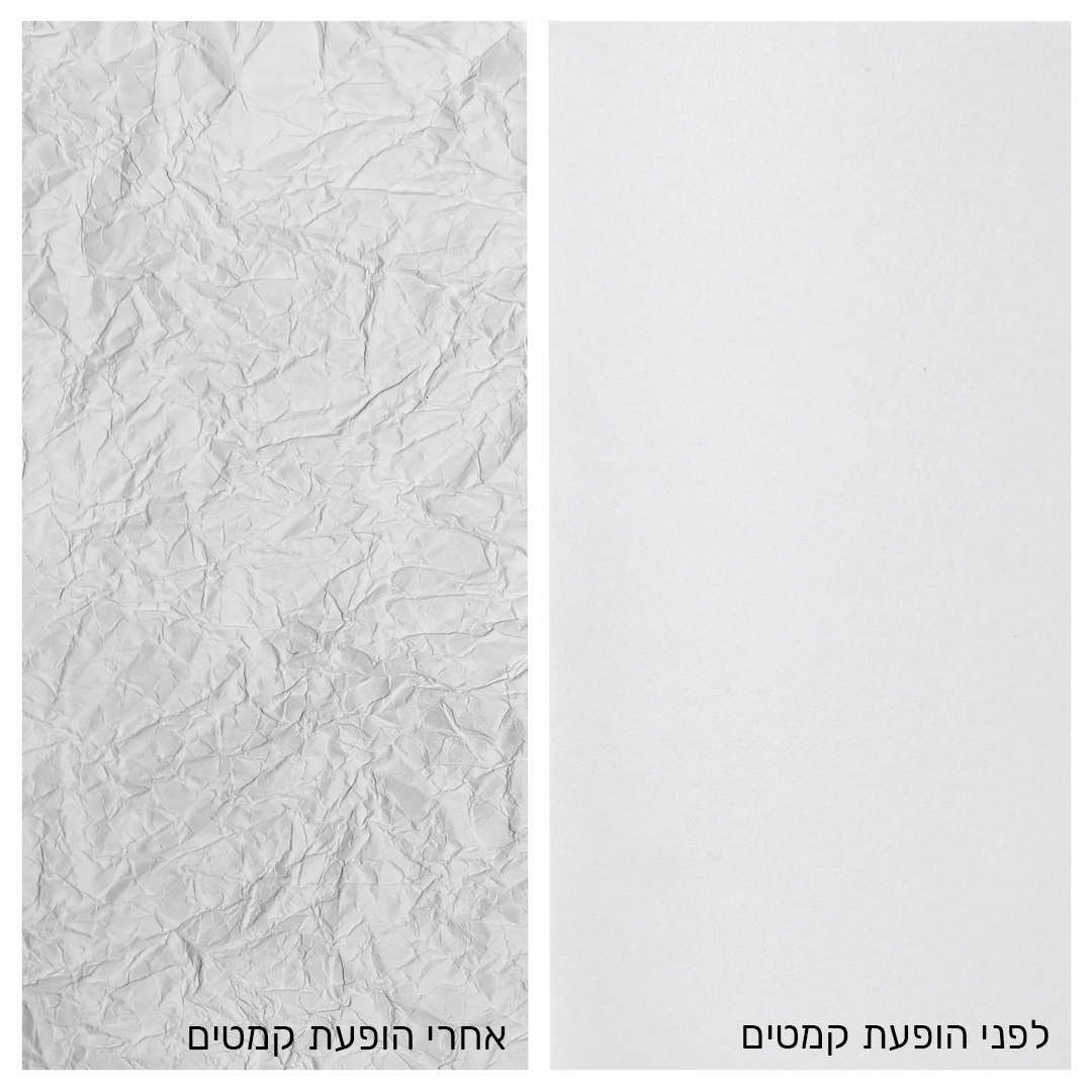 טיפולים להעלמת קמטים_בוטוקס וחומצה היאלורונית_מנתח פלסטי_לאוניד קוגן